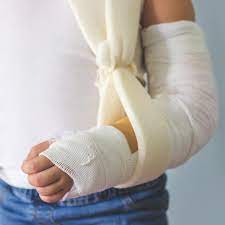 The knowledge about fractures