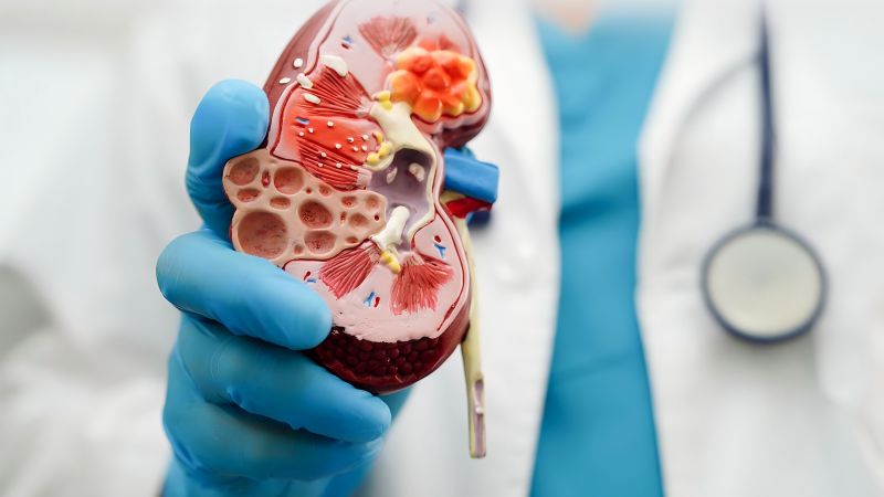 Chronic Kidney Disease: Early Symptoms And How To Manage Them